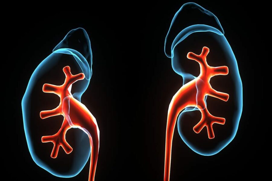 Canadians with bladder cancer